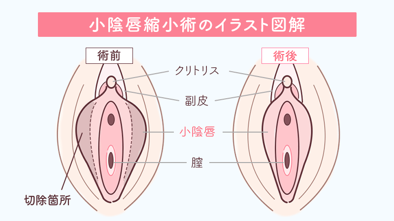 アウトレット 【トレファク東久留米店】ノーリツ 都市ガスファンヒーター