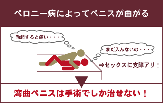 高二男子です。ここ一、二ヶ月くらいから息子の曲りが酷くなってきていてほ - Yahoo!知恵袋