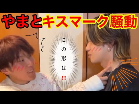 キスマークをつける理由って？ 意外と知らない、男性の心理を解説 - Peachy（ピーチィ） -