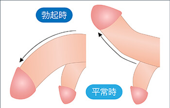 あの『ペニスの形』には意味があるの？ちんこの亀頭があの形の理由【ラブコスメ】