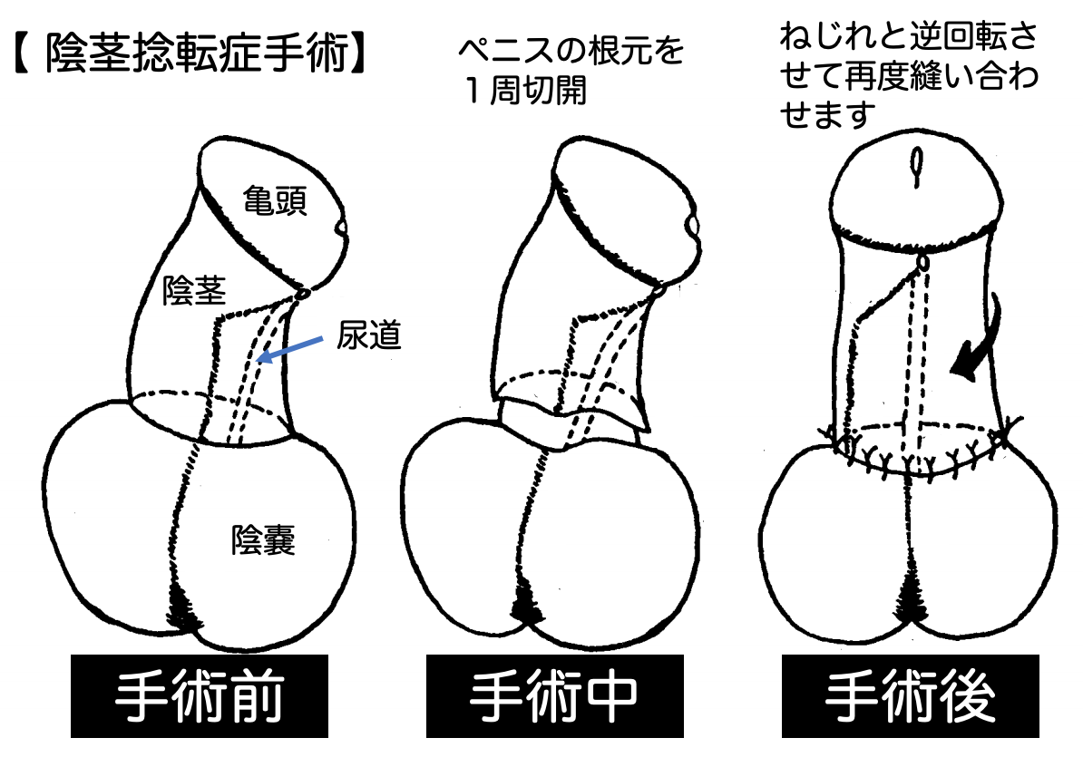 オナホアンケート】あなたのペニスはまっすぐですか？ : オナホ動画.com | オナホールをＨＤ動画で毎日レビュー！